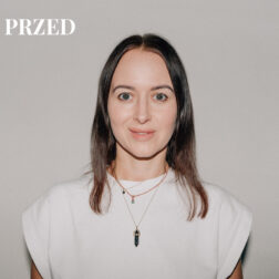 Włosy przed założeniem toppera - cienkie i bez objętości.