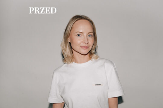 Włosy przed założeniem toppera Volume Lab Ekstraktt Poznań